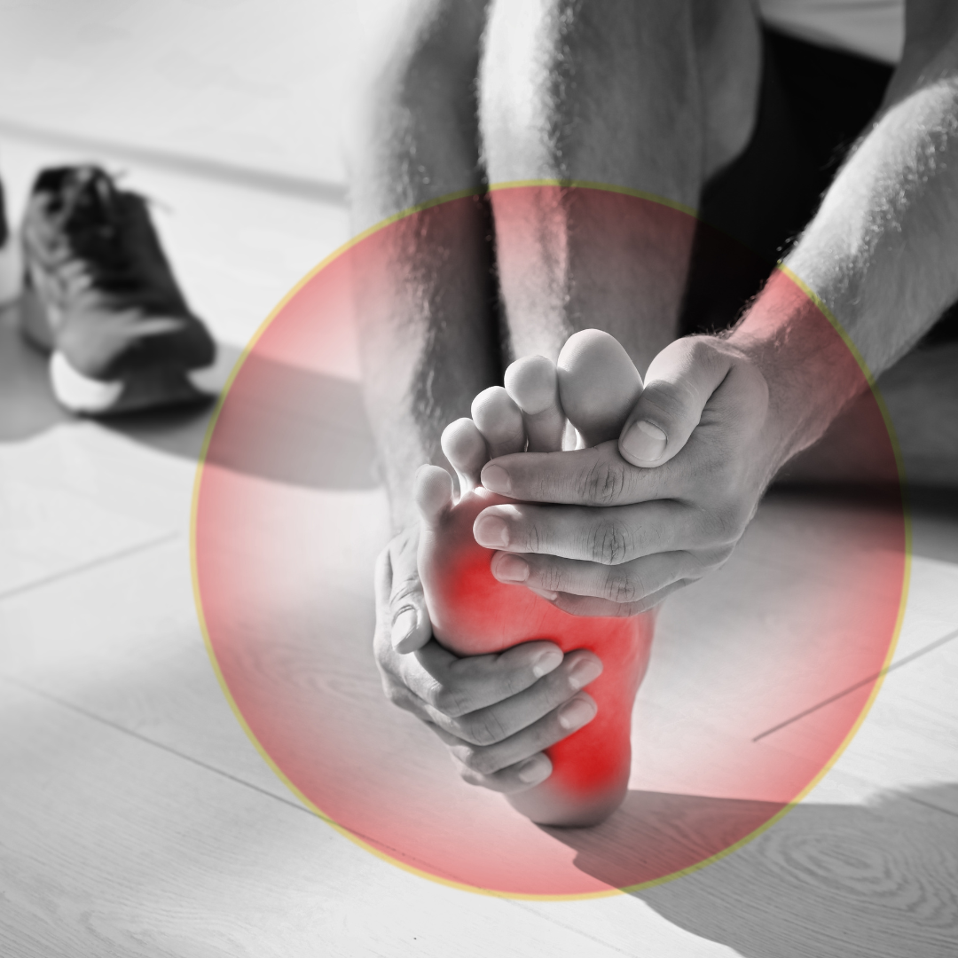 Image of a foot with Morton's neuroma