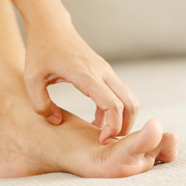 SO, its all about athletes foot!