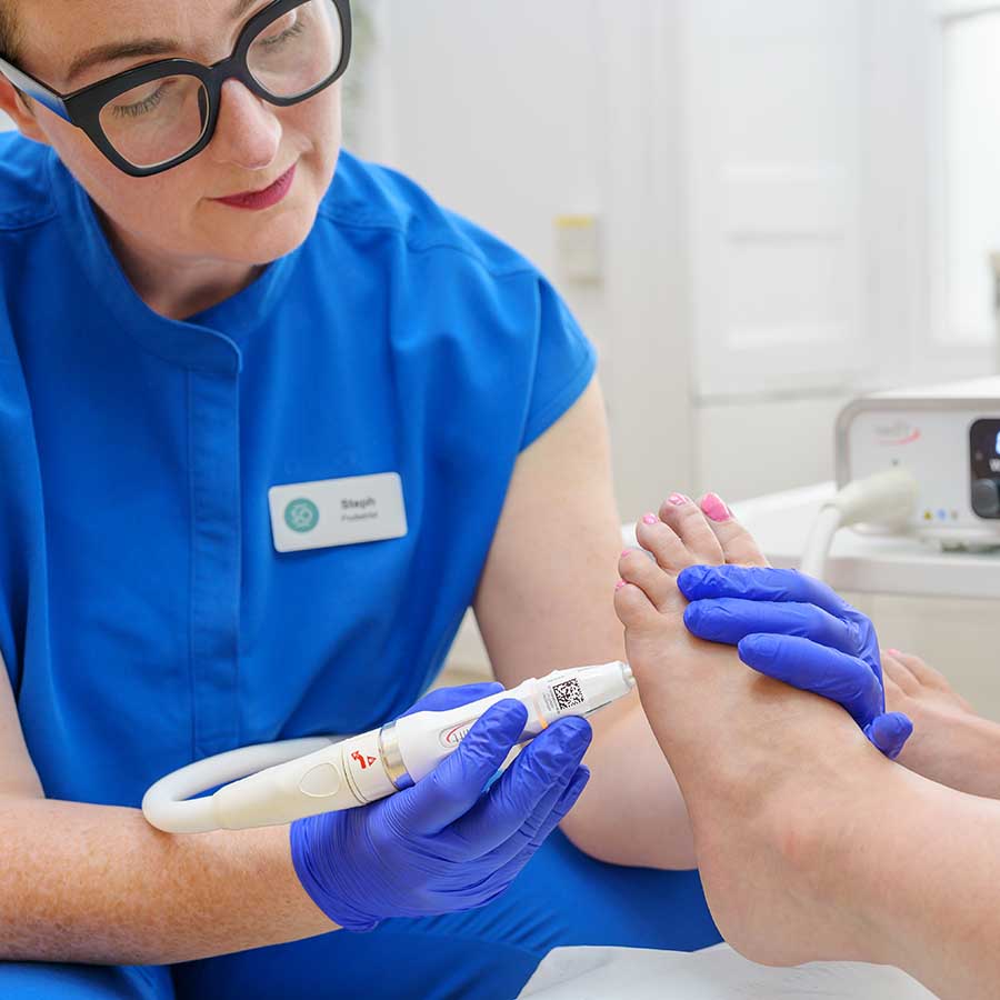 Verruca Removal - 3039 - Swift Microwave Therapy Application To Verruca On Foot